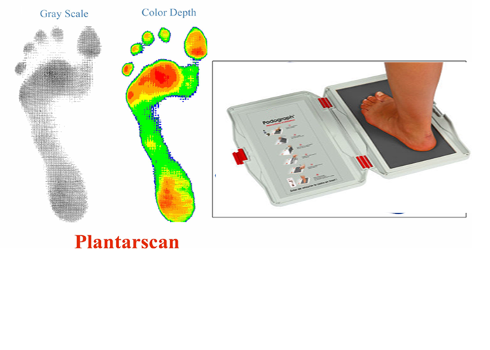 Plantarscan