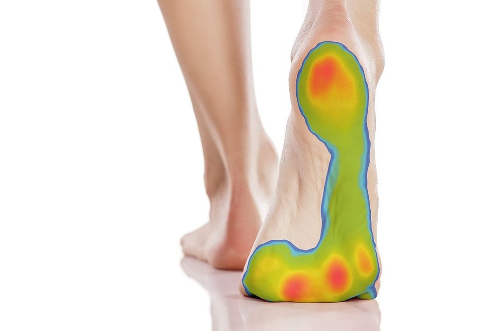 Scanner Digital Foot Scan/ Podoscan/ Pressure Mapping/ Diabetic Foot Scan, For Clinical