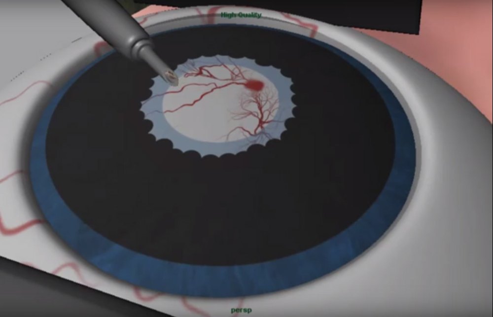 3D Medical Animation Service