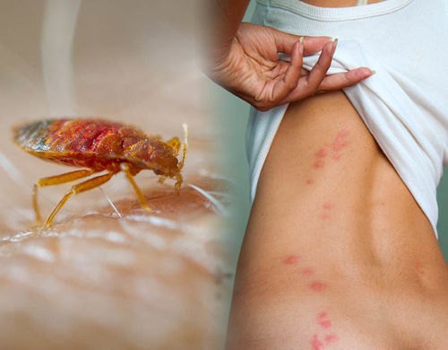 Bed Bugs Pest Control