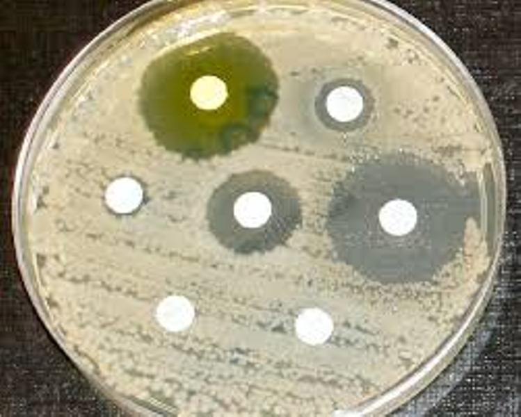 Antibacterial Activity Of Compound Biological Testing Services