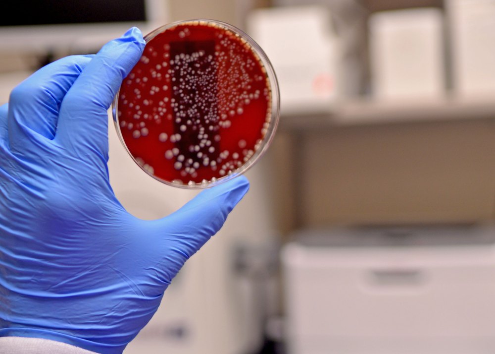 Pathogen Testing Services, for Food & Water Industry