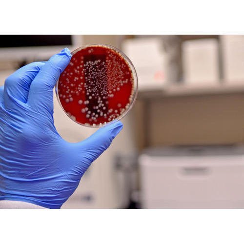 Pathogen Testing Services