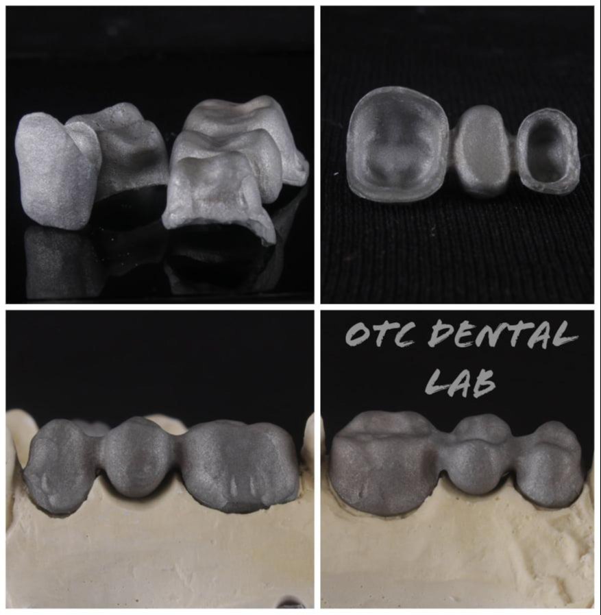 gray Medical 3d Printing Metal, Size: Small